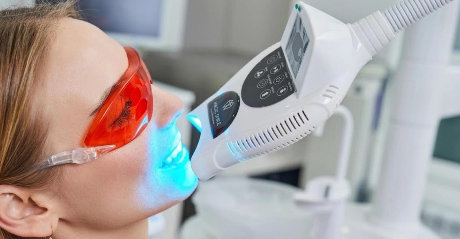Translated copy of Same Day Teeth Whitening1